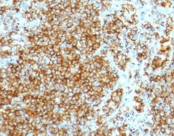 Recombinant HCAM Antibody