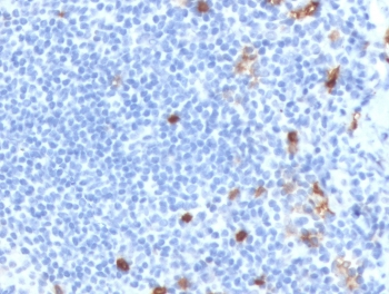 Recombinant IgM Antibody