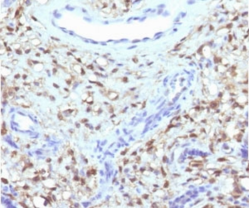 S100A4 Antibody / FSP1