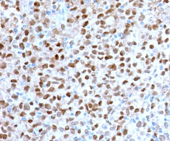 Recombinant MITF Antibody