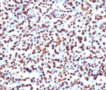 SOX9 Antibody