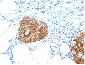 NCAM / CD56 Antibody