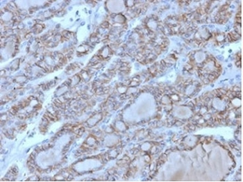 NCAM / CD56 Antibody