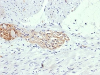 NCAM / CD56 Antibody