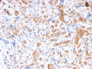 SPTA1 Antibody / Spectrin alpha 1