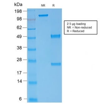 SPTA1 Antibody / Spectrin alpha 1