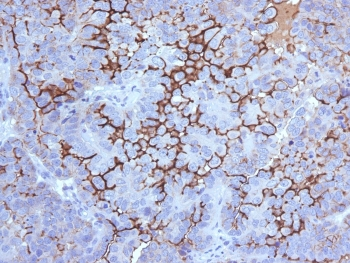MUC16 Antibody / CA125