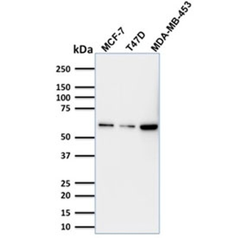 p63 Antibody / Tumor protein 63