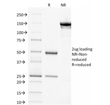 p63 Antibody / Tumor protein 63