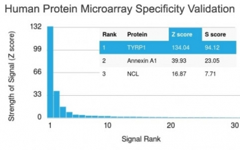 TRP1 / Tyrosinase-Related Protein-1 Antibody