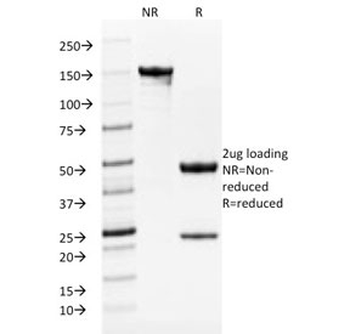 TRP1 / Tyrosinase-Related Protein-1 Antibody