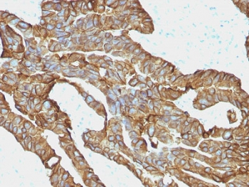EpCAM Antibody / Extracellular domain