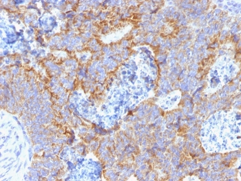 CEA Antibody / Carcinoembryonic Antigen