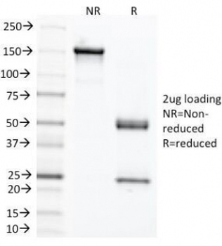 CEA Antibody / Carcinoembryonic Antigen