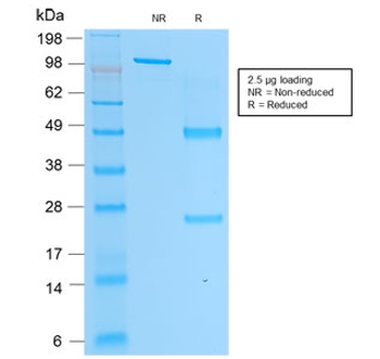 PSAP Antibody / Prostate Specific Acid Phosphatase