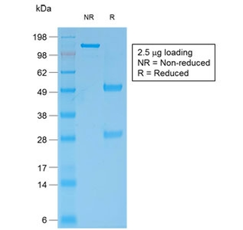 Bcl-2 Antibody