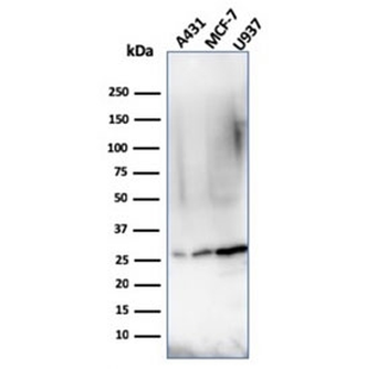 Bcl-2 Antibody