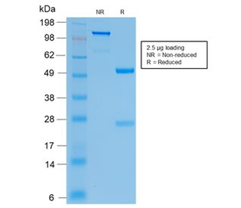 CFTR Antibody / Cystic Fibrosis Transmembrane Regulator