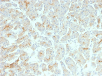 CFTR Antibody / Cystic Fibrosis Transmembrane Regulator