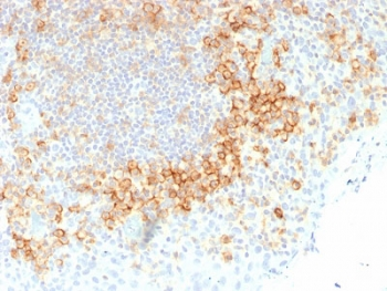 CD27 Antibody