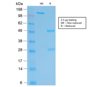 HCG-beta Antibody