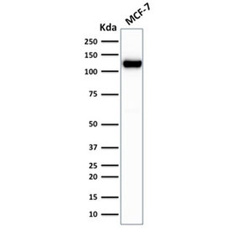 E-Cadherin Antibody / CDH1