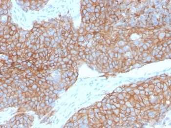 E-Cadherin Antibody / CDH1