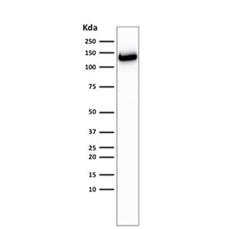E-Cadherin Antibody / CDH1
