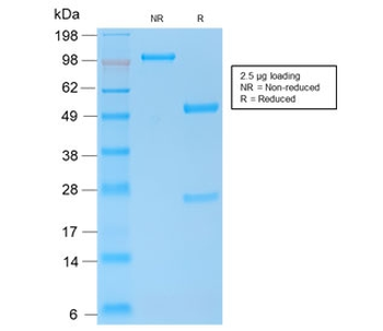 E-Cadherin Antibody / CDH1