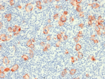 Recombinant CD30 Antibody