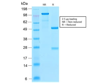 FTL Antibody / Ferritin light chain