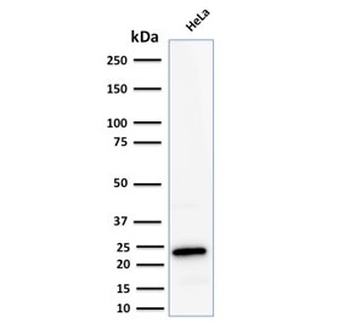 FTL Antibody / Ferritin light chain