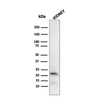 FTL Antibody / Ferritin light chain