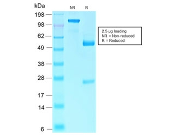 Retinoblastoma Antibody / Rb1