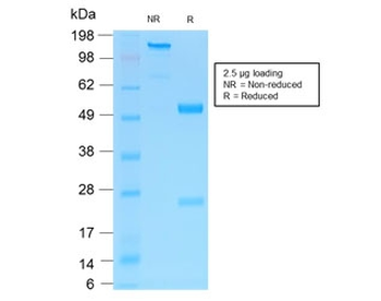 NGF Receptor Antibody / p75NTR / CD271