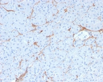 NGF Receptor Antibody / p75NTR / CD271