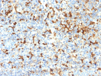 TRP1 / Tyrosinase-Related Protein-1 Antibody