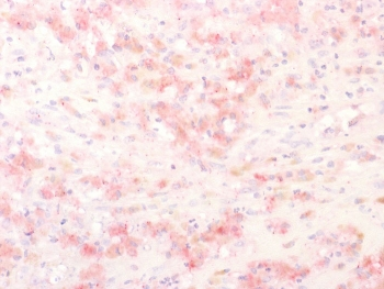TRP1 / Tyrosinase-Related Protein-1 Antibody