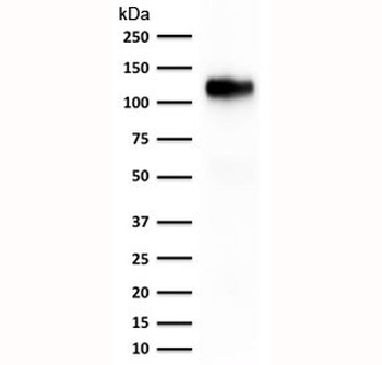 Cadherin 16 Antibody