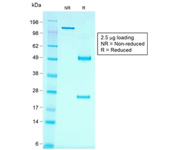 Cadherin 16 Antibody