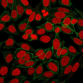 Beta Catenin Antibody