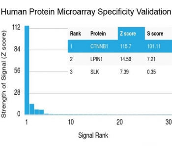 Beta Catenin Antibody
