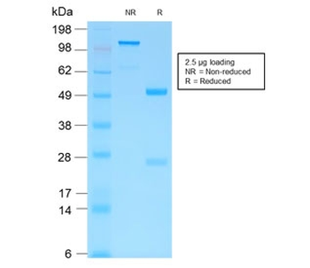 HCG-beta Antibody