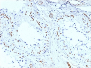 WT1 Antibody / Wilms Tumor 1