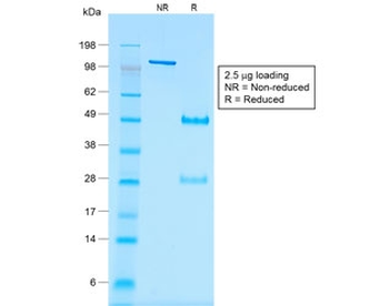 WT1 Antibody / Wilms Tumor 1