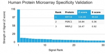 KRT19 Antibody / Cytokeratin 19