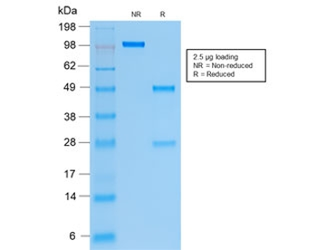 KRT19 Antibody / Cytokeratin 19
