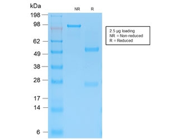KRT15 Antibody / Cytokeratin 15