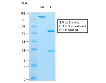 Insulin Antibody