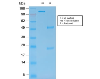 MMP9 Antibody / Matrix metalloproteinase-9